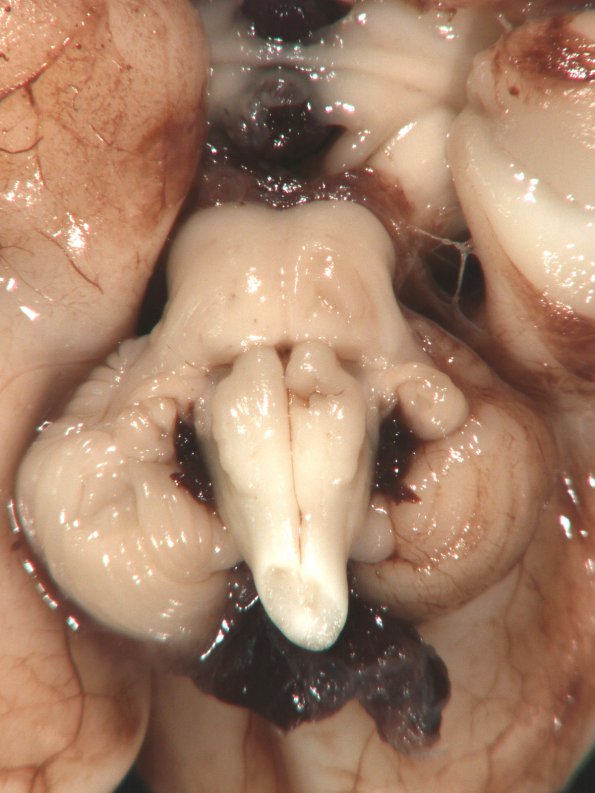 14A2 Hemorrhage, neonatal, premature (Case 14) gross_1