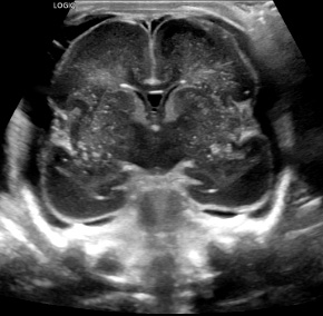 28A2 Ultrasound CNS (8-10-2025) 1 3PM - Copy