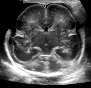 28A3 Ultrasound CNS (8-10-2025) 2 3PM - Copy