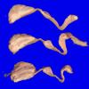 30B10B (Case 30) 034