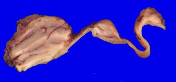 30B10D (Case 30) 038