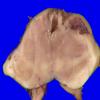 30B11 (Case 30) 040