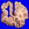 30B4 (Case 30) A