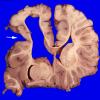 30B6A (Case 30) A