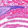 5C2 Fetal vascularization (Case 5) H&E 10X