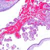 5C3 Fetal vascularization (Case 5) H&E 2X A