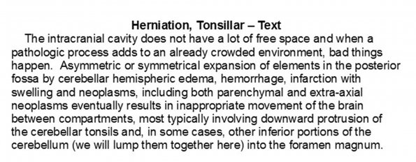 0A Herniation, Tonsillar - Text.docx