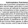 0A Hydrocephalus, post-hemorrhagic - Text