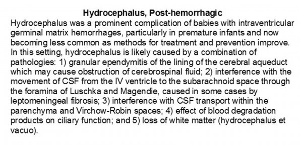 0A Hydrocephalus, post-hemorrhagic - Text