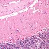 2B2 Hypoxia-ischemia (Case 2) H&E 1 copy