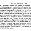 0A1 Hypoxia-Ischemia, adult - Hippocampus