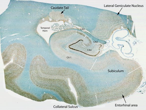 0A2 Hippocampus, normal NeuN 1 (labeled)