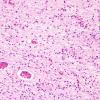 2C1 Hypoxia-Ischemia (Case 2) Pons H&E 6