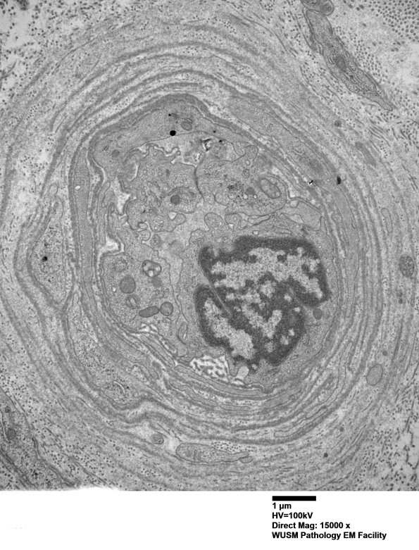 13C1 (Case 13) EM022 - Copy