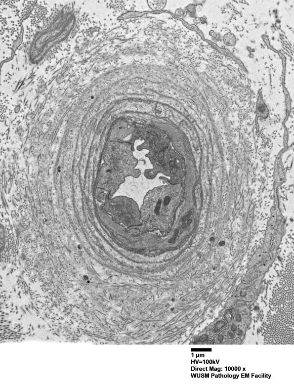 13C2 (Case 13) EM024 - Copy