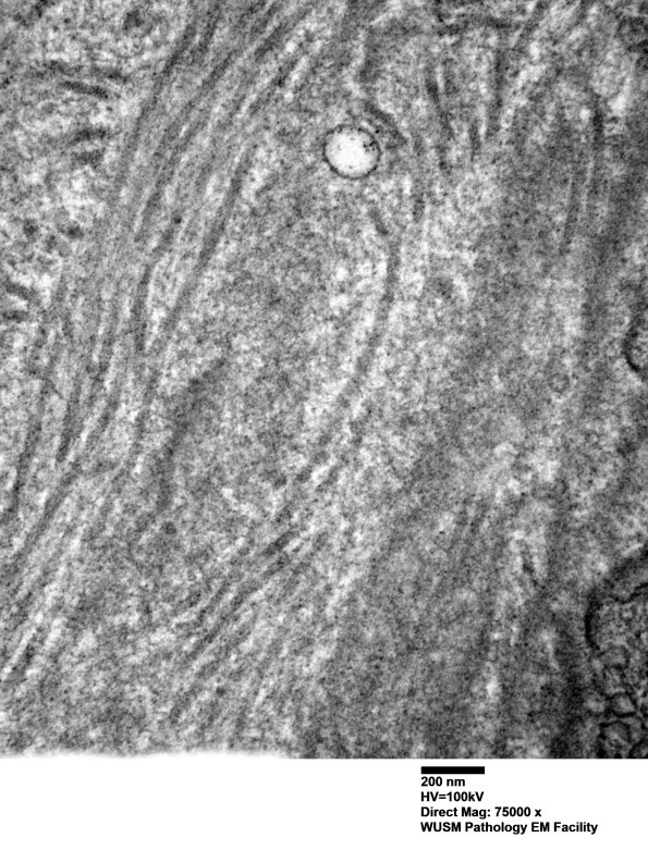 14B1D (Case 14) EM006 - Copy