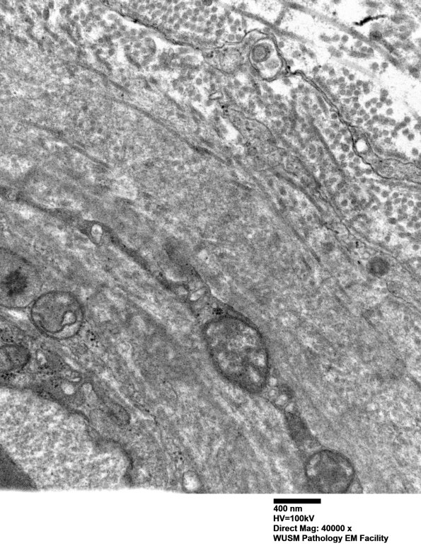 14B2C (Case 14) EM013 - Copy