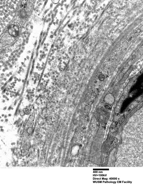 14B2D (Case 14) EM014 - Copy