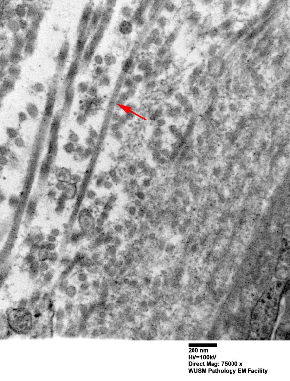 14B2E (Case 14) EM015 - Copy copy