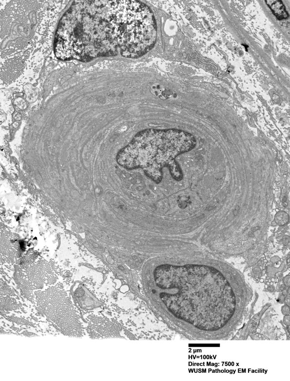 14B3A (Case 14) EM017 - Copy