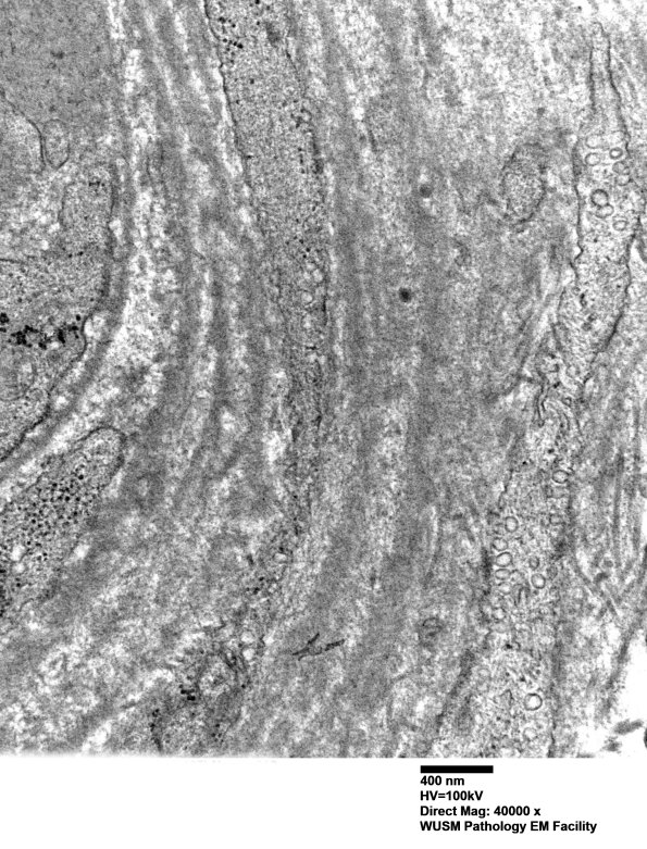 14B3C (Case 14) EM019 - Copy