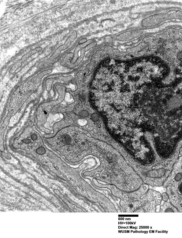 16B3 (Case 16) HIEM EM020 - Copy