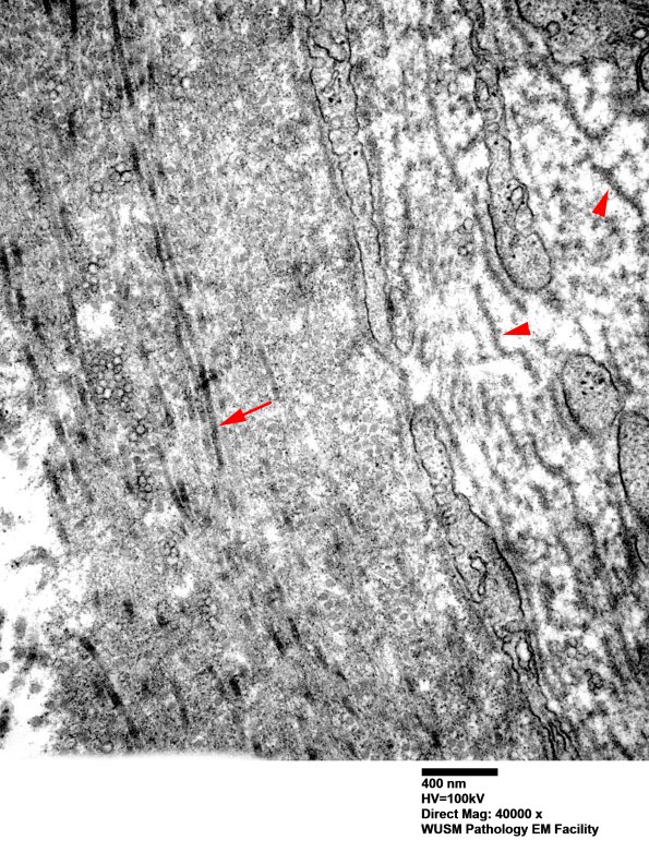5C3 (Case 5) EM047 - Copy copy