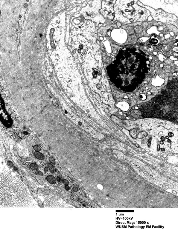 5C5 (Case 5) EM066 - Copy