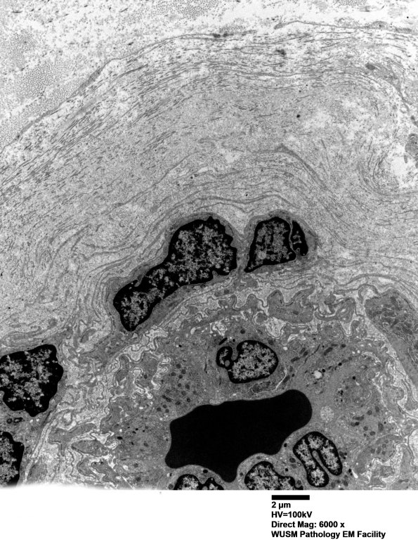 6C5 (Case 6) EM 014 - Copy