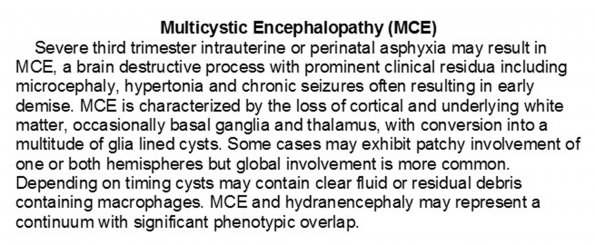 0A Multicystic Encephalopathy - Text