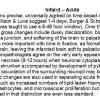 0A Infarct - Acute Text