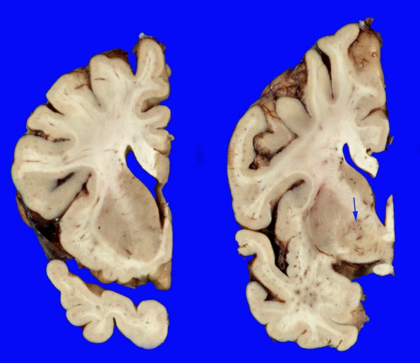 6A Case 6 GP lesion copy