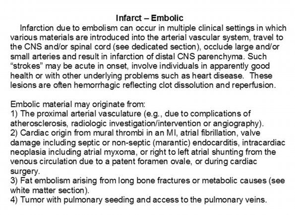 0A Infarct - Embolic Text