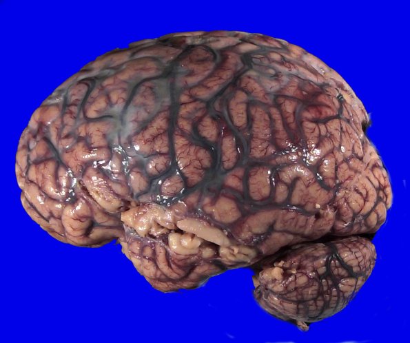 24B1 (Case 24) A.004