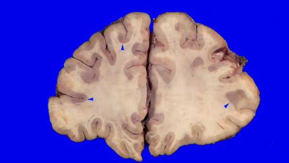 24B2 (Case 24) A