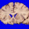 24B3 (Case 24) A.013