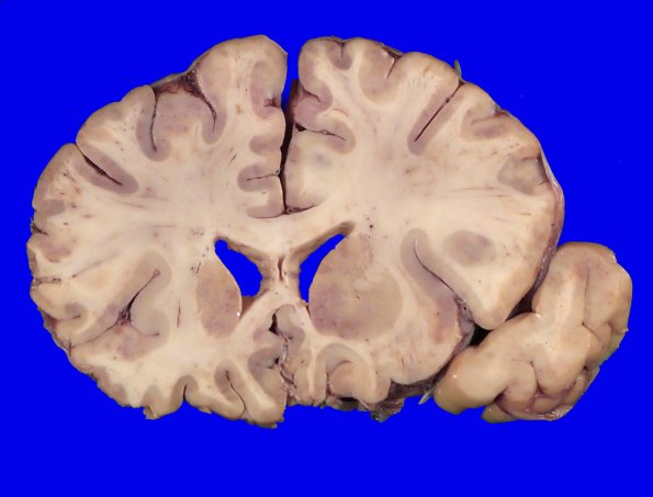 24B3 (Case 24) A.013