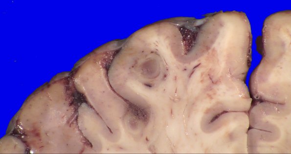 24B4B (Case 24) A.019