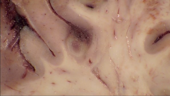 24B4D (Case 24) A.021