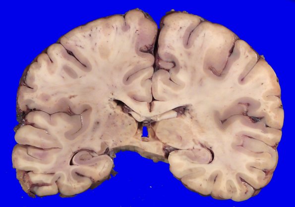24B6A (Case 24) A.023