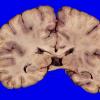 24B7 (Case 24) A.026