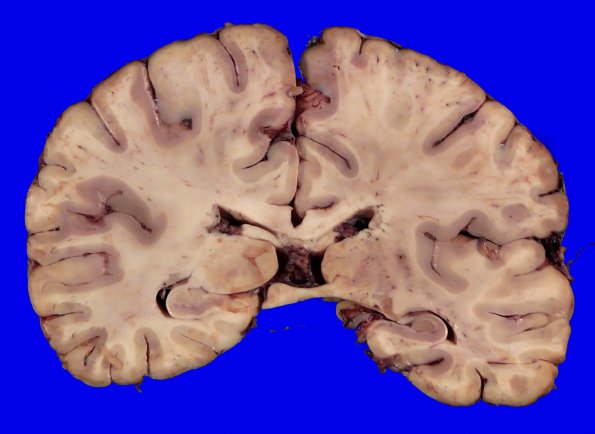 24B7 (Case 24) A.026