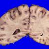 24B8A (Case 24) A.027