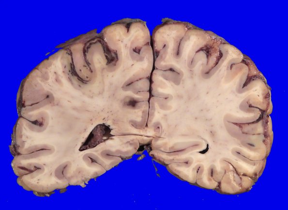 24B8A (Case 24) A.027