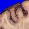 24B8B (Case 24) A.028