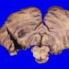 24B9A (Case 24) A.048