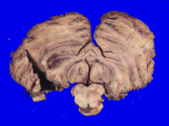 24B9A (Case 24) A.048