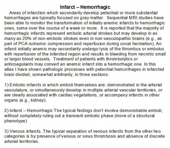 0A Infarct - Hemorrhagic