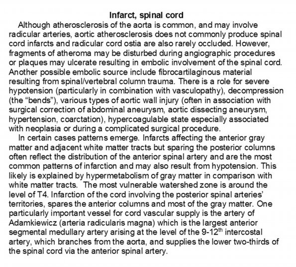 0A Infarct, spinal cord - Text