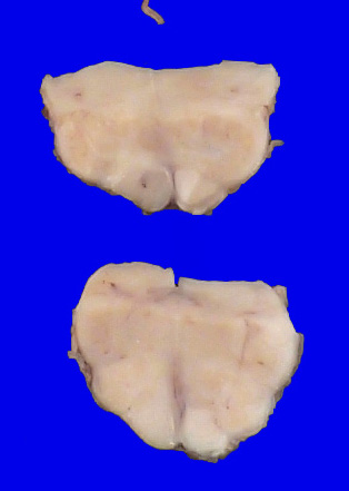 22B10 (Case 22) A.043